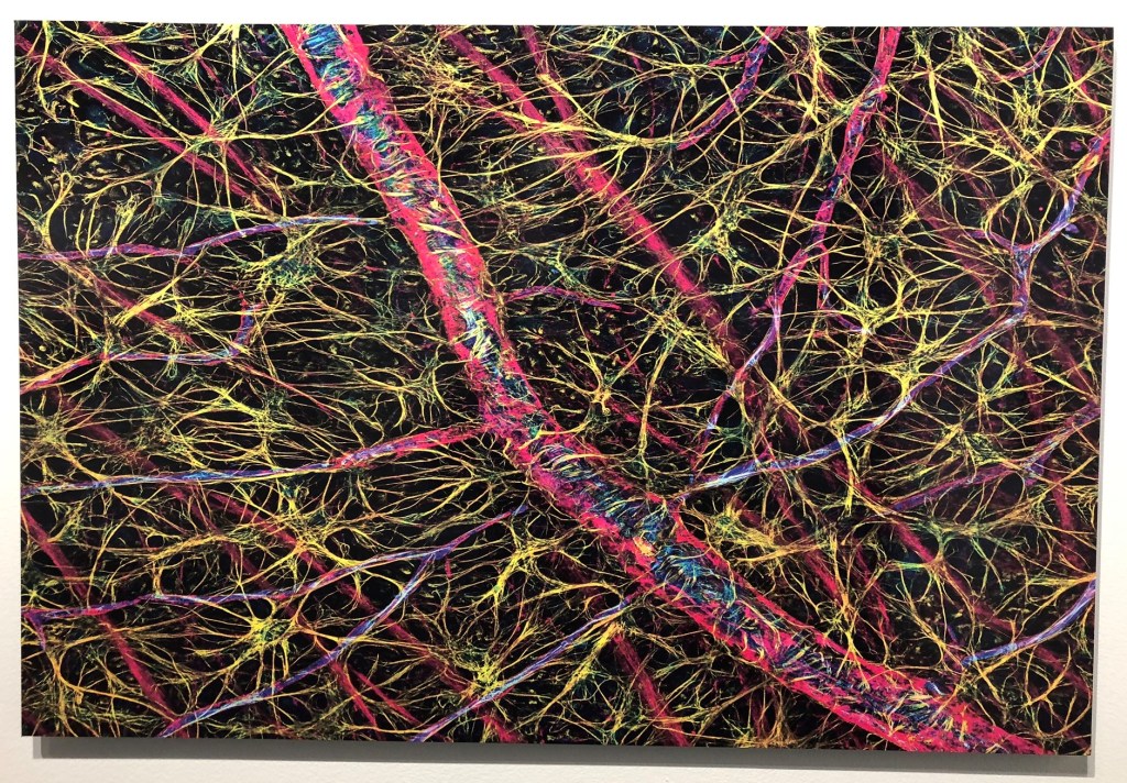 Astrocytes and blood vessels